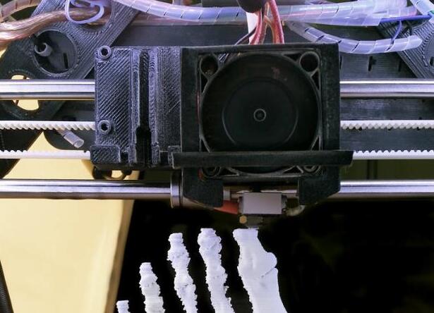 西南地區首例！四川省人民醫院為患者裝上3D打印半骨盆